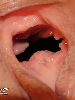 extreme speculum gaping pics